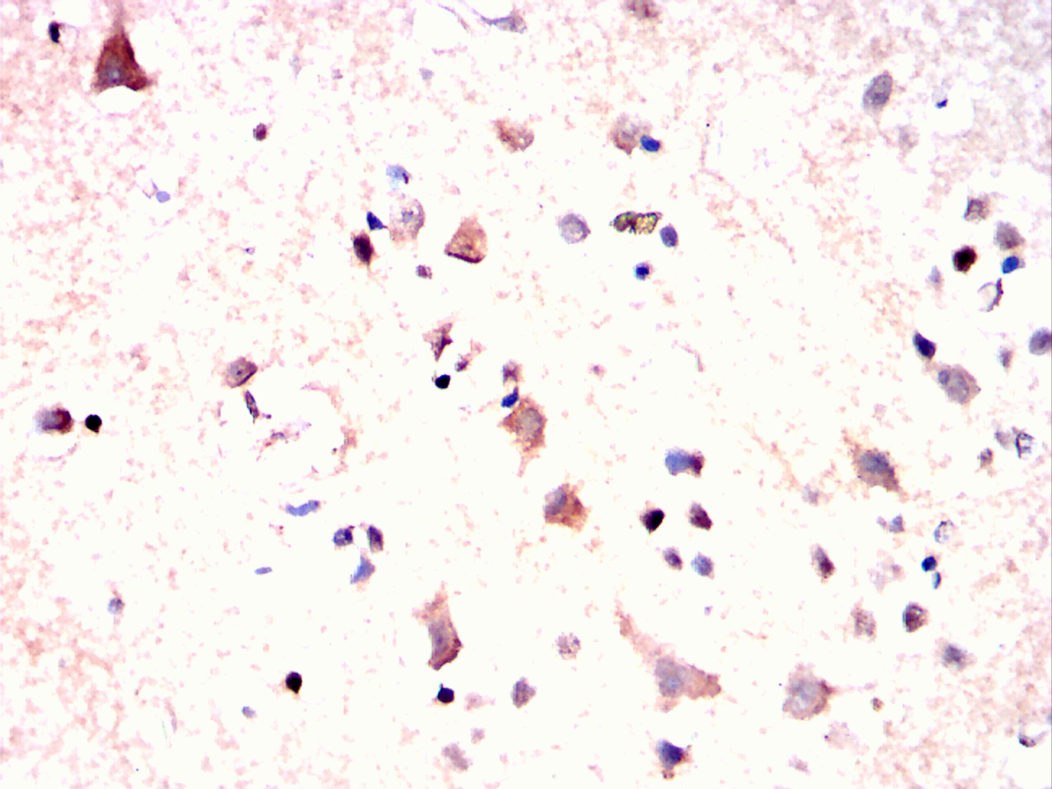                         IHC
